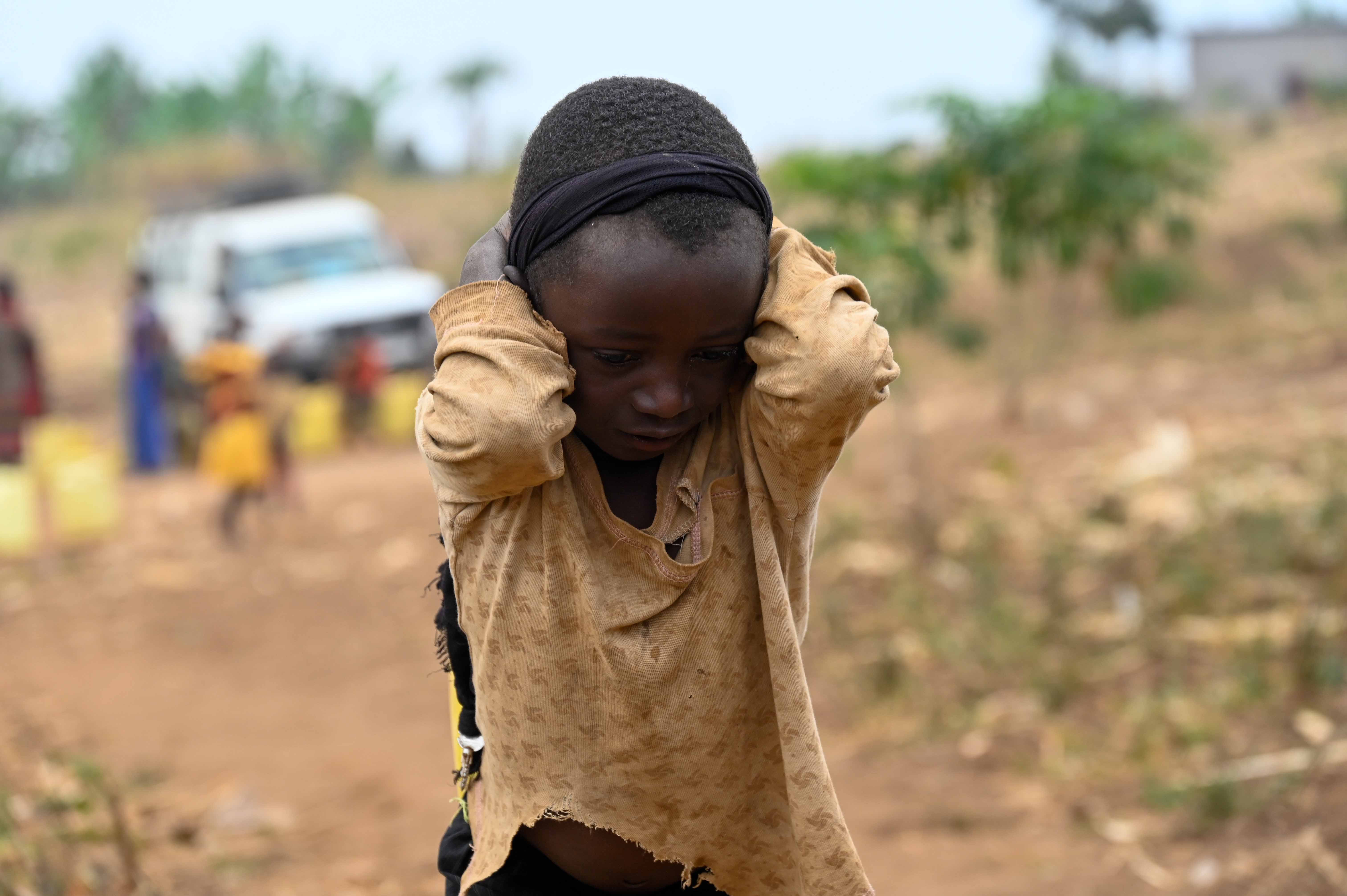 A close-up of a refugee boy in Uganda holding his head in his hands hopelessly.