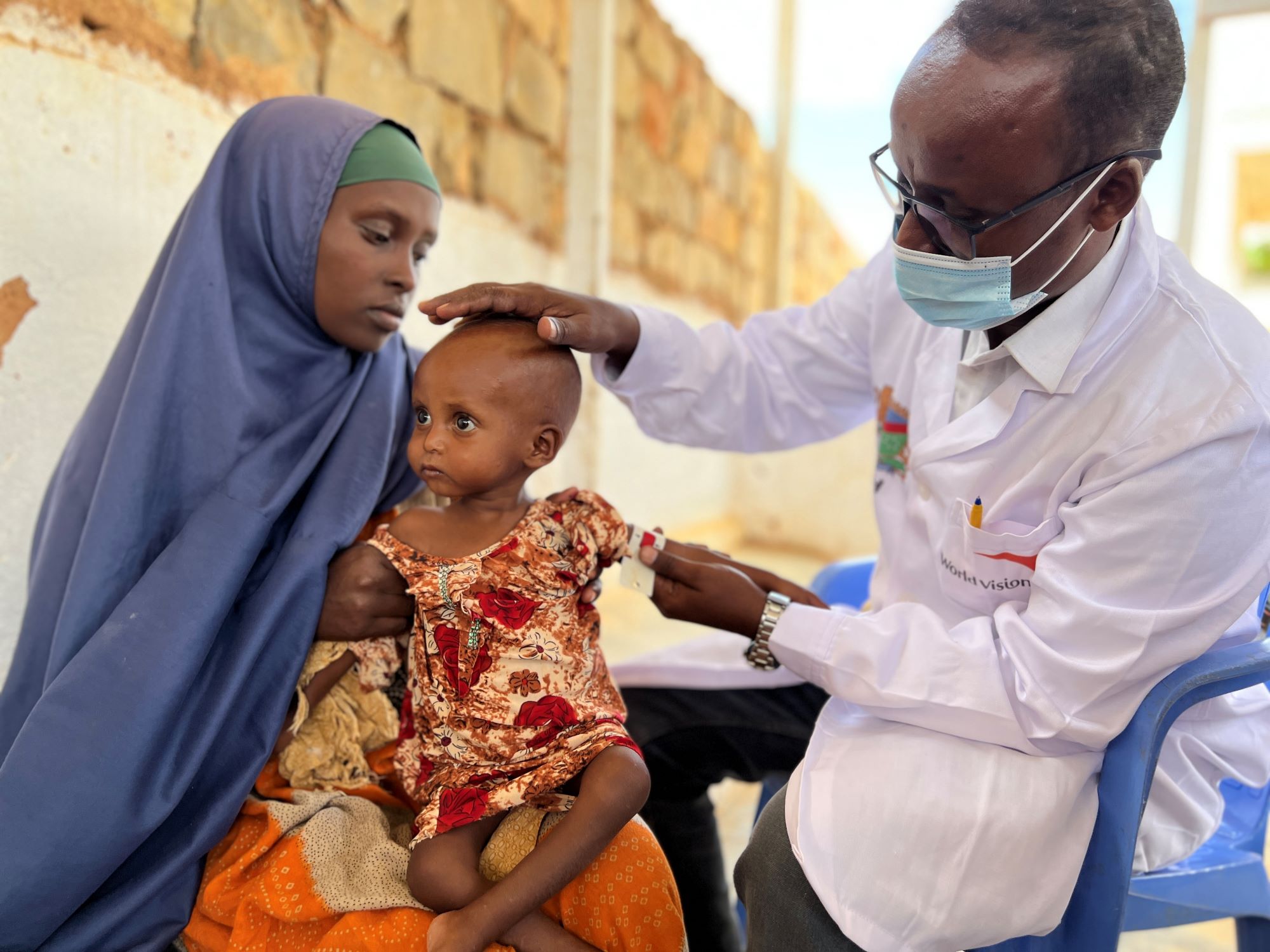 Child in Somalia is one of millions affected by global hunger crisis