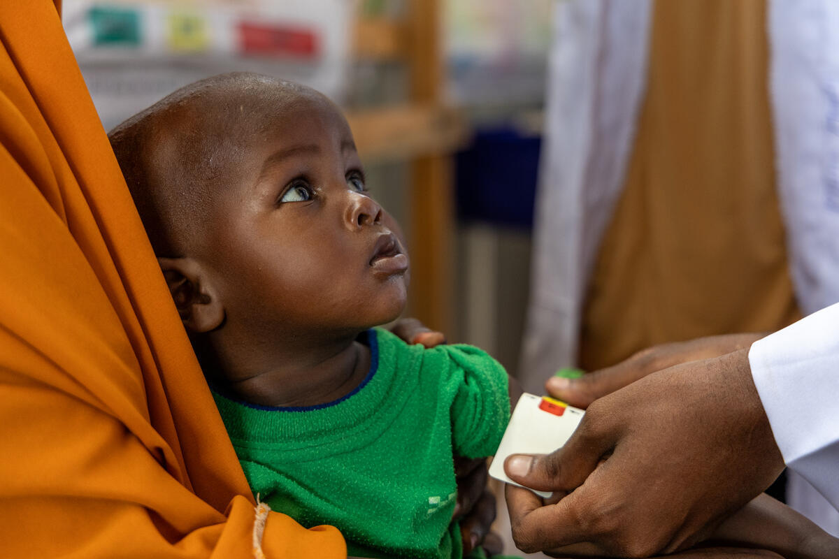 Baby boy being checked for malnutrition, by a WV health member of staff.